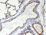 IHC testing of FFPE rat lung tissue with TSPAN12 antibody at 1ug/ml. Required HIER: steam section in pH6 citrate buffer for 20 min and allow to cool prior to testing.