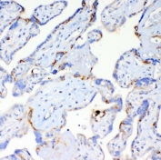 IHC staining of FFPE human placental tissue with DYNLT1 antibody. HIER: boil tissue sections in pH8 EDTA for 20 min and allow to cool before testing.