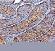Immunohistochemical staining of FFPE mouse testis tissue with DYNLT1 antibody, HRP-secondary and DAB substrate. HIER: boil tissue sections in pH8 EDTA for 20 min and allow to cool before testing.