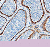 Immunohistochemical staining of FFPE mouse epididymis tissue with DYNLT1 antibody, HRP-secondary and DAB substrate. HIER: boil tissue sections in pH8 EDTA for 20 min and allow to cool before testing.