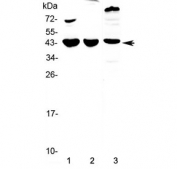 Western blot testing of 1) mouse heart, 2) mouse brain and 3) rat heart lysate with Il18bp antibody at 0.5ug/ml. Expected molecular weight: ~21 kDa unmodified and up to ~45 kDa glycosylated.