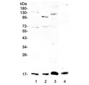 Western blot testing of 1) rat brain, 2) rat lung, 3) rat RH35 and 4) mouse lung lysate with Il1f10 antibody at 0.5ug/ml. Predicted molecular weight ~17 kDa.