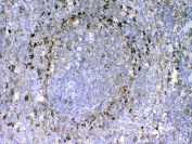 IHC testing of FFPE rat spleen tissue with LAMP3 antibody at 1ug/ml. Required HIER: steam section in pH6 citrate buffer for 20 min and allow to cool prior to testing.