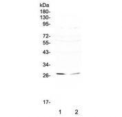 Western blot testing of 1) human SW620 and 2) human HepG2 cell lysate with RNF186 antibody at 0.5ug/ml. Predicted molecular weight ~24 kDa.