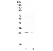 Western blot testing of 1) human SW620 and 2) human HepG2 cell lysate with RNF186 antibody at 0.5ug/ml. Predicted molecular weight ~24 kDa.