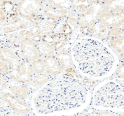 IHC staining of FFPE human kidney tissue with HLA-DQB1 antibody, HRP-secondary and DAB substrate. HIER: boil tissue sections in pH8 EDTA for 20 min and allow to cool before testing.