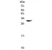 Western blot testing of human SK-OV-3 cell lysate with HLA-DQB1 antibody at 0.5ug/ml. Predicted molecular weight ~30 kDa.