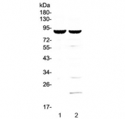 Western blot testing of 1) mouse spleen and 2) mouse thymus lysate with CD19 antibody at 0.5ug/ml. Expected molecular weight: 60~100 kDa depending on glycosylation level.