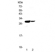 Western blot testing of 1) mouse spleen and 2) mouse thymus lysate with IL17C antibody at 0.5ug/ml. Predicted molecular weight ~22 kDa, observed here at ~29 kDa.