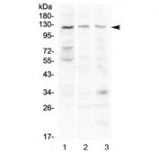 Western blot testing of 1) human COLO320, 2) mouse pancreas and 3) mouse lung lysate with TLR3 antibody at 0.5ug/ml. Predicted molecular weight ~104 kDa, observed here at ~120 kDa.