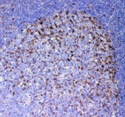 IHC testing of FFPE human tonsil tissue with ICOS antibody at 1ug/ml. Required HIER: steam section in pH6 citrate buffer for 20 min and allow to cool prior to staining.