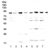 Western blot testing of human 1) HeLa, 2) HepG2, 3) 22RV1, 4) MCF7, 5) rat thymus, 6) rat kidney and 7) mouse kidney lysate with BAP1 antibody at 0.5ug/ml. Expected molecular weight: 80-100 kDa.