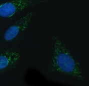 Immunofluorescent staining of FFPE human U-2 OS cells with NADPH oxidase 4 antibody (green) and DAPI nuclear stain (blue). HIER: steam section in pH6 citrate buffer for 20 min.