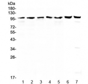 Western blot testing of human 1) HeLa, 2) COLO320, 3) HepG2, 4) A431, 5) SK-OV-3, 6) rat testis and 7) mouse testis lysate with Topoisomerase I antibody at 0.5ug/ml. Predicted molecular weight: 91-100 kDa.