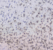 IHC testing of FFPE rat brain tissue with L1CAM antibody at 1ug/ml. Required HIER: steam section in pH6 citrate buffer for 20 min and allow to cool prior to staining.