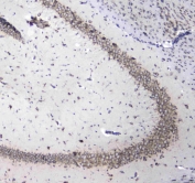 IHC testing of FFPE mouse brain tissue with L1CAM antibody at 1ug/ml. Required HIER: steam section in pH6 citrate buffer for 20 min and allow to cool prior to staining.