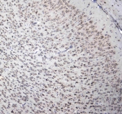 IHC testing of FFPE mouse brain tissue with L1CAM antibody at 1ug/ml. Required HIER: steam section in pH6 citrate buffer for 20 min and allow to cool prior to staining.