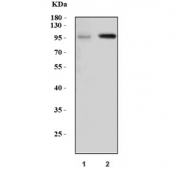 Western blot testing of 1) human HeLa and 2) rat skeletal muscle lysate with DYRK1A antibody. Predicted molecular weight ~85 kDa, observed here at ~100 kDa.
