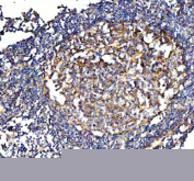 Immunohistochemical staining of FFPE human appendix tissue with VCAM1 antibody, HRP-secondary and DAB substrate. HIER: boil tissue sections in pH8 EDTA for 20 min and allow to cool before testing.