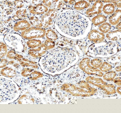 Immunohistochemical staining of FFPE human kidney tissue with VCAM1 antibody, HRP-secondary and DAB substrate. HIER: boil tissue sections in pH8 EDTA for 20 min and allow to cool before testing.