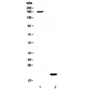 Western blot testing of 1) human COLO320 and 2) human placenta lysate with COL18A1 antibody at 0.5ug/ml. Predicted molecular weight: ~178 (NC1-728), ~154 kDa (Long, NC-493), ~136 kDa (Short, NC1-303), ~20 kDa (Endostatin).