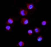 Immunofluorescent staining of FFPE human K562 cells with CD16 antibody (red) and DAPI nuclear stain (blue). HIER: steam section in pH6 citrate buffer for 20 min.