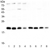 Western blot testing of rat 1) brain, 2) kidney, 3) heart, 4) testis and mouse 5) brain, 6) kidney, 7) heart and 8) testis lysate with BNIP3 antibody at 0.5ug/ml. Expected molecular weight: 19-21 kDa.
