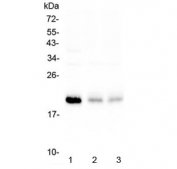Western blot testing of human 1) HeLa, 2) A375 and 3) A549 cell lysate with BNIP3 antibody at 0.5ug/ml. Expected molecular weight: 19-21 kDa.