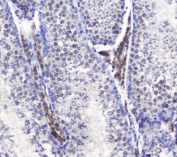 IHC staining of FFPE mouse testis tissue with SMC6 antibody at 1ug/ml. HIER: boil tissue sections in pH6, 10mM citrate buffer, for 10-20 min and allow to cool before testing.