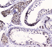 IHC staining of FFPE human testis tissue with SMC6 antibody at 1ug/ml. HIER: boil tissue sections in pH6, 10mM citrate buffer, for 10-20 min and allow to cool before testing.