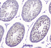 IHC staining of FFPE rat testis tissue with SMC6 antibody at 1ug/ml. HIER: boil tissue sections in pH6, 10mM citrate buffer, for 10-20 min and allow to cool before testing.