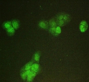 Immunofluorescent staining of FFPE human A431 cells with SMC6 antibody. HIER: boil tissue sections in pH6, 10mM citrate buffer, for 20 min and allow to cool before testing.