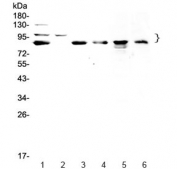 Western blot testing of human 1) HeLa, 2) COLO320, 3) U-87 MG, 4) SGC-7901, 5) rat PC-12 and 6) mouse HEPA1-6 lysate with TPX2 antibody at 0.5ug/ml. Predicted molecular weight ~86 kDa, observed at ~100 kDa.