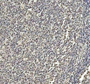 IHC staining of FFPE human tonsil tissue with DCK antibody. HIER: boil tissue sections in pH8 EDTA for 20 min and allow to cool before testing.