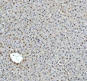 IHC staining of FFPE rat liver tissue with DCK antibody. HIER: boil tissue sections in pH8 EDTA for 20 min and allow to cool before testing.