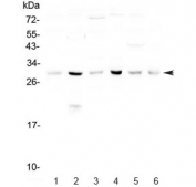 Western blot testing of 1) mouse spleen, 2) mouse thymus and human 3) HeLa, 4) U-87 MG, 5) MCF7 and 6) U-2 OS lysate with DCK antibody at 0.5ug/ml. Predicted molecular weight ~30 kDa. 