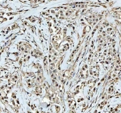 IHC staining of FFPE mouse small intestine with DCK antibody at 1ug/ml. HIER: boil tissue sections in pH6, 10mM citrate buffer, for 10-20 min followed by cooling at RT for 20 min.