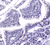 IHC staining of FFPE rat small intestine with DCK antibody at 1ug/ml. HIER: boil tissue sections in pH6, 10mM citrate buffer, for 10-20 min followed by cooling at RT for 20 min.