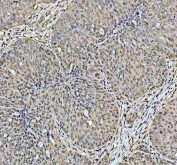 IHC staining of FFPE rat small intestine with DCK antibody at 1ug/ml. HIER: boil tissue sections in pH6, 10mM citrate buffer, for 10-20 min followed by cooling at RT for 20 min.