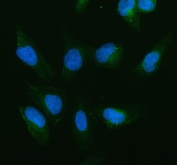 IF/ICC staining of FFPE human U-2 OS cells with cIAP1 antibody (green) at 5ug/ml and DAPI nuclear stain (blue). HIER: steam section in pH6 citrate buffer for 20 min.