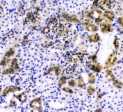 IHC staining of FFPE rat kidney with CD2AP antibody at 1ug/ml. HIER: boil tissue sections in pH6, 10mM citrate buffer, for 10-20 min and allow to cool before testing.