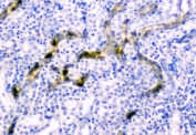 IHC staining of FFPE mouse kidney with CD2AP antibody at 1ug/ml. HIER: boil tissue sections in pH6, 10mM citrate buffer, for 10-20 min and allow to cool before testing.