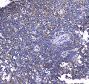 IHC testing of FFPE mouse brain tissue with SYT1 antibody at 1ug/ml. Required HIER: steam section in pH6 citrate buffer for 20 min and allow to cool prior to staining.