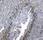 IHC testing of FFPE rat brain tissue with SYT1 antibody at 1ug/ml. Required HIER: steam section in pH6 citrate buffer for 20 min and allow to cool prior to staining.