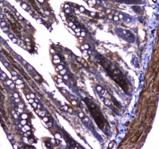 IHC testing of FFPE rat small intestine tissue with Dynamin 1 antibody at 1ug/ml. Required HIER: steam section in pH6 citrate buffer for 20 min and allow to cool prior to staining.