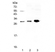 Western blot testing of 1) human 22RV1, 2) rat skeletal muscle and 3) mouse HEPA1-6 lysate with VEGFB antibody at 0.5ug/ml. Expected molecular weight: 22-32 kDa depending on glycosylation level.