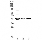 Western blot testing of human 1) MCF7, 2) HepG2 and 3) SK-OV-3 cell lysate with P2RY5 antibody at 0.5ug/ml. Predicted molecular weight ~39 kDa.