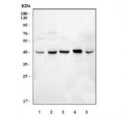 Western blot testing of human 1) HepG2, 2) RT4, 3) HaCaT, 4) T-47D and 5) A549 cell lysate with P2RY5 antibody at 0.5ug/ml. Predicted molecular weight ~39 kDa.