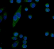 Immunofluorescent staining of FFPE human SiHa cells with Serum Amyloid P antibody (green) and DAPI nuclear stain (blue). HIER: steam section in pH6 citrate buffer for 20 min.
