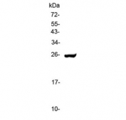 Western blot testing of human placenta lysate with Serum Amyloid P antibody at 0.5ug/ml. Predicted molecular weight ~25 kDa.